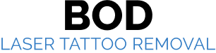 BOD LASER TATTOO REMOVAL